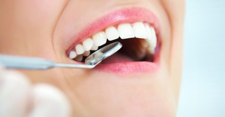 Checkup With Scale And Polish Dubai TMLH.com Special Offers, Deals & Discounts in Turkey