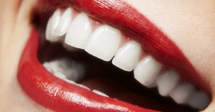 Dental Check-Up With Optional Stain Removal, Or Laser Teeth Whitening Dubai TMLH.com Special Offers, Deals & Discounts in Turkey