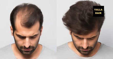 Extensions / Feathering Dubai TMLH.com Special Offers, Deals & Discounts in Turkey