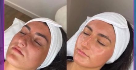 Facial – Anti-Ageing Dubai TMLH.com Special Offers, Deals & Discounts in Turkey
