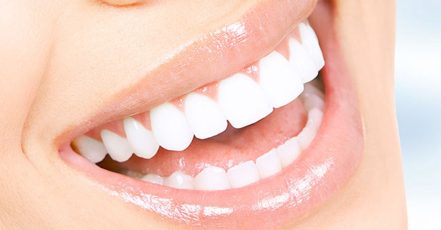 Scaling And Polishing With X-Ray At Omar Yahia Dental Surgery Clinic Dubai TMLH.com Special Offers, Deals & Discounts in Turkey